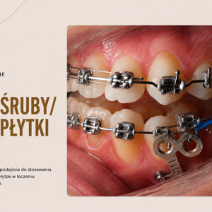 VOD: “Miniśruby/minipłytki cz.2"