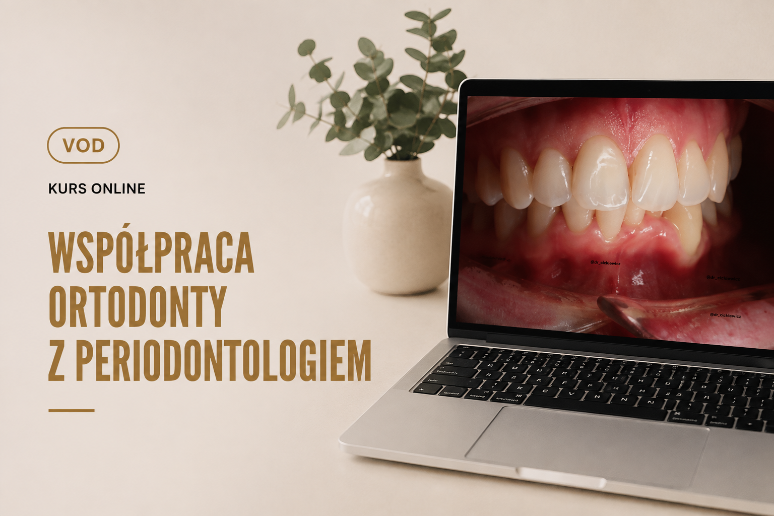 Współpraca ortodonty z periodontologiem