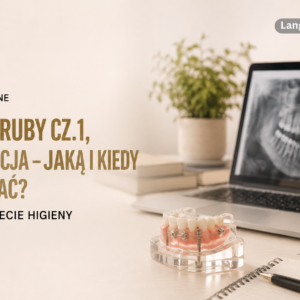 VOD: Miniśruby cz.1,  Retencja - jaką i kiedy wybrać?,  Mój pierwszy pacjent z Invisaling.