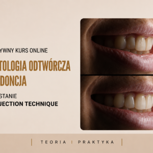 VOD Stomatologia odtwórcza a ortodoncja - wykorzystanie FLOW INJECTION TECHNIQUE