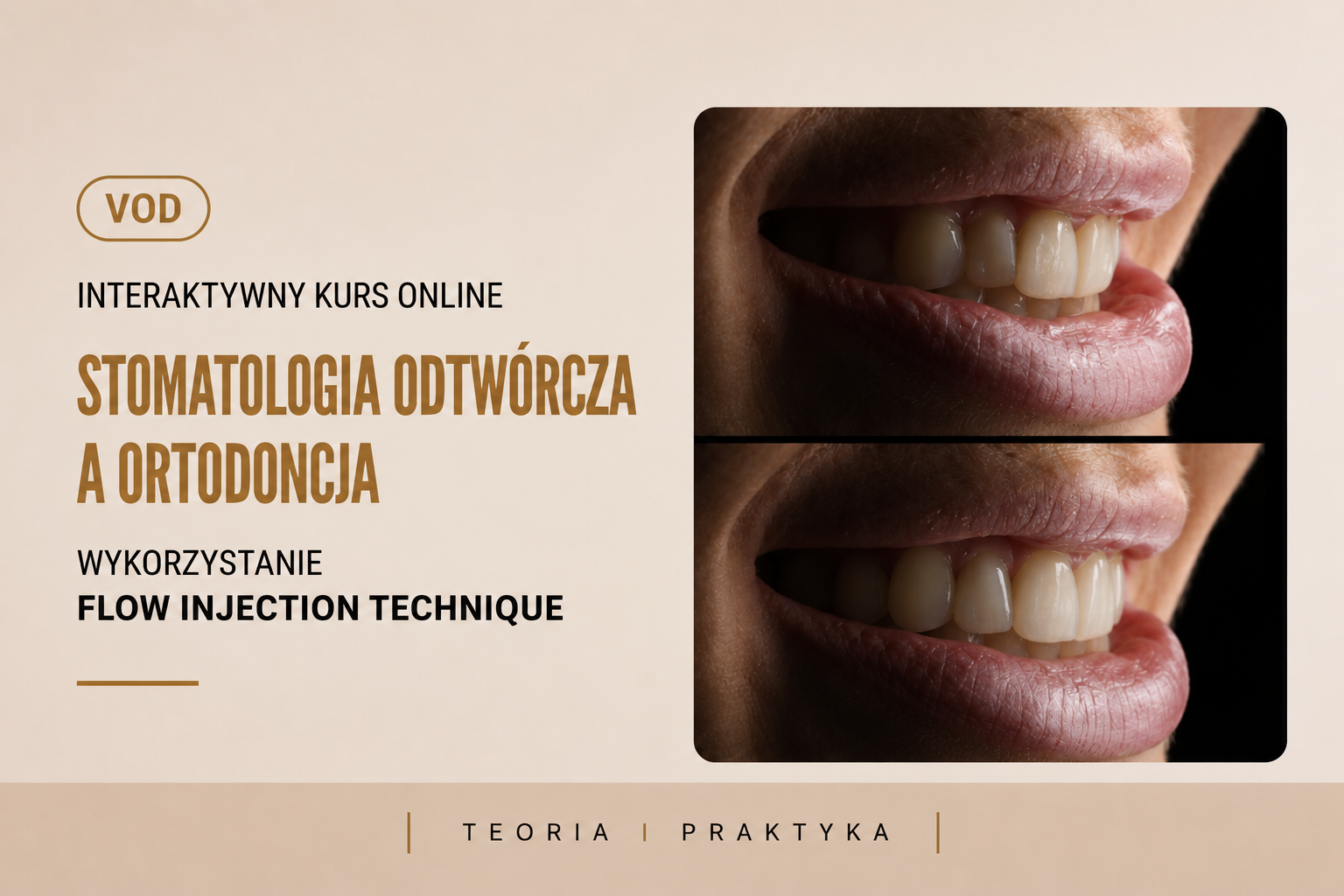 VOD Stomatologia odtwórcza a ortodoncja – wykorzystanie FLOW INJECTION TECHNIQUE