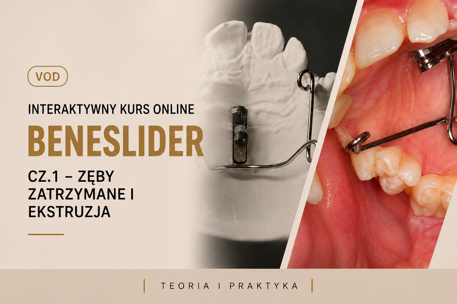 Interaktywny kurs ONLINE – BENESLIDER cz.1 – ZĘBY ZATRZYMANE I EKSTRUZJA